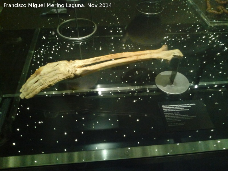 Museo Arqueolgico de Tenerife - Museo Arqueolgico de Tenerife. Brazo momificado