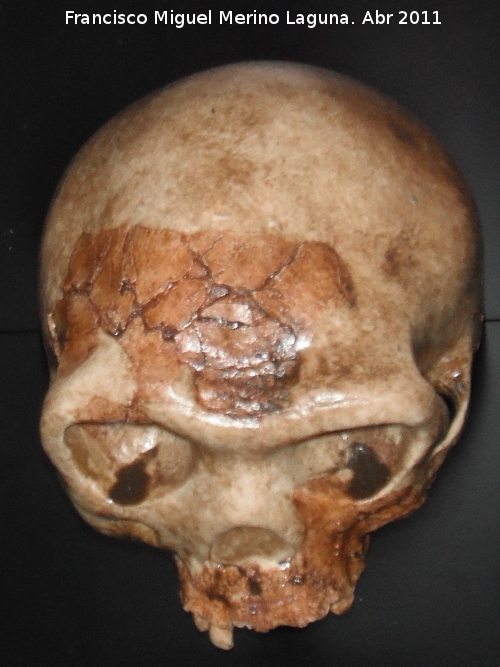 Homo antecessor - Homo antecessor. Atapuerca - Burgos
