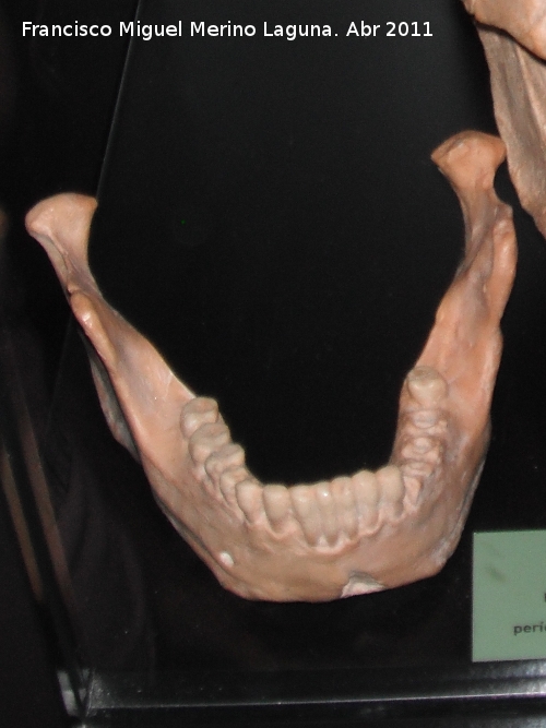 Homo heidelbergensis - Homo heidelbergensis. Mandbula de Mauer. Alemania