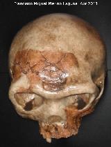 Homo antecessor. Atapuerca - Burgos